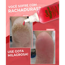 Gota Milagrosa Para Pés Combate Rachadura E Ressecamento